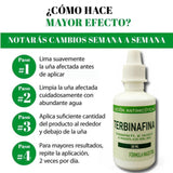 GOTAS DE TERBINAFINA| QUITA HONGOS